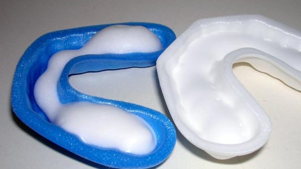 Fluoride Facts (featured image)