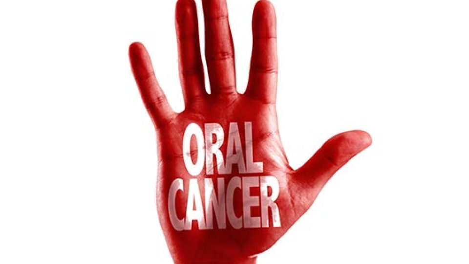 Oral Cancer (featured image)