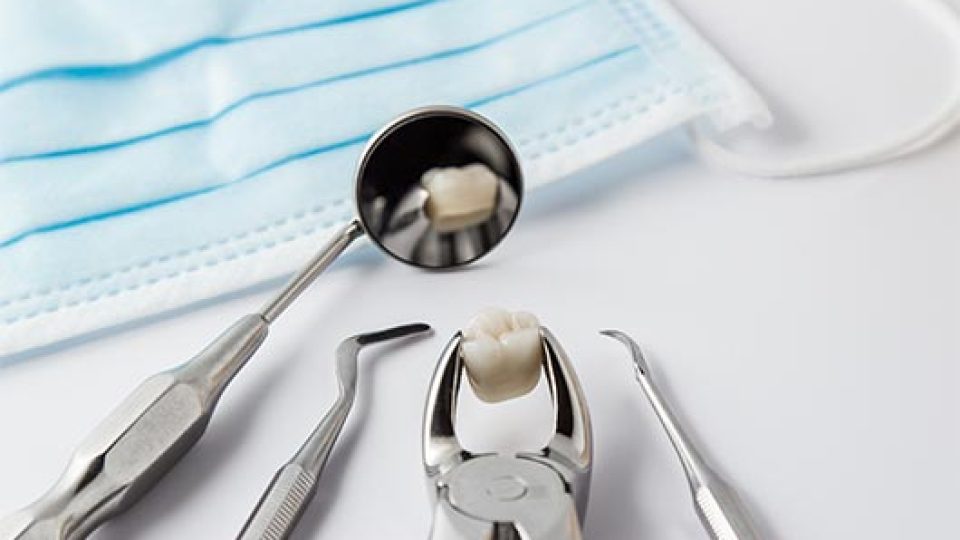 Tooth Extractions (featured image)